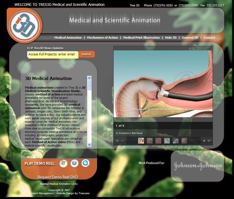 Tres 3D Medical Animation